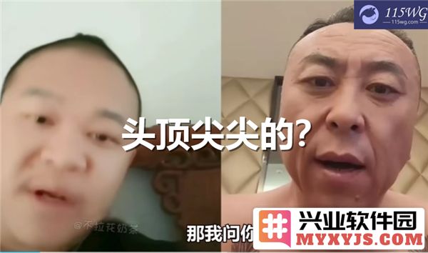 飞机头顶为何如尖尖之状？常熟阿诺头顶尖尖之谜探究