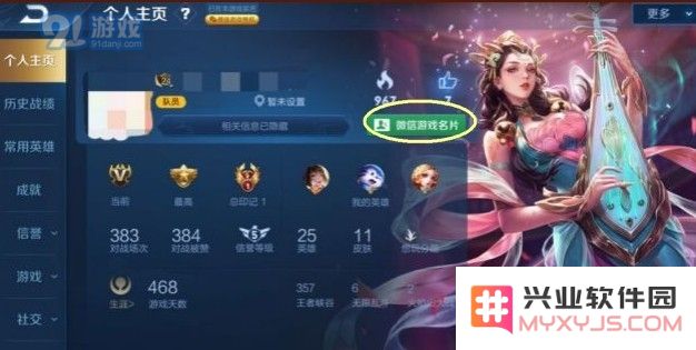 如何取消王者荣耀中的微信游戏名片功能及相关设置方法