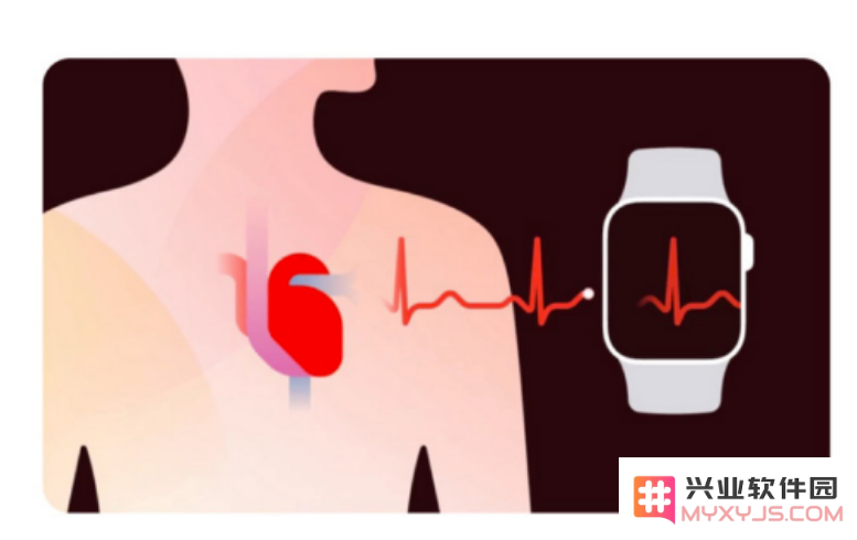如何开通国行 Apple Watch 的心电图检测功能？详细使用教程及步骤解析