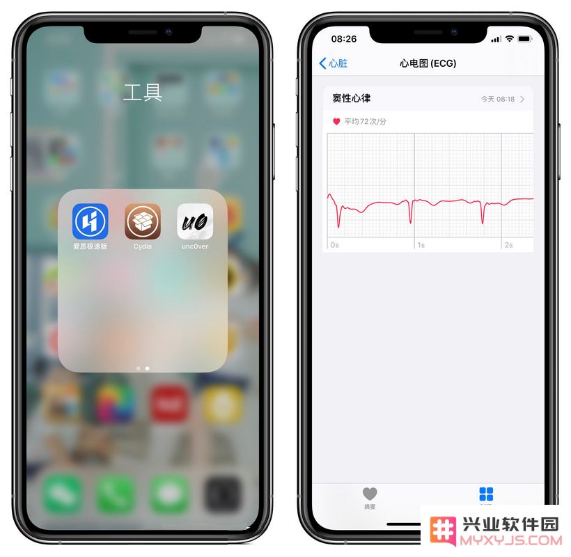 越狱后如何在国行版 Apple Watch 上激活 ECG 心电图功能的详细教程
