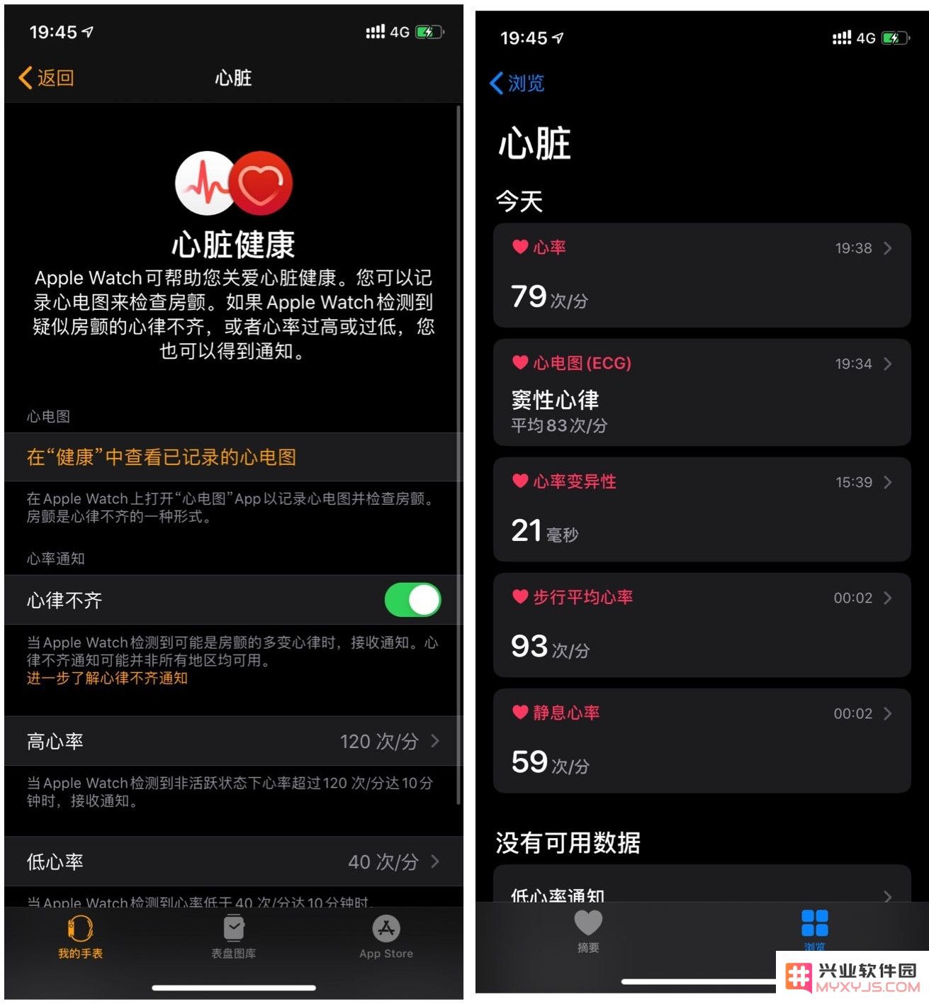 如何在国行版 Apple Watch 上成功开通心电图（ECG）功能及其步骤解析？