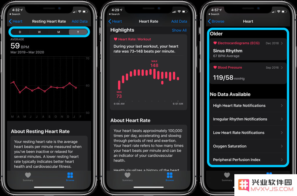 Apple Watch 教程：如何查看心率记录？