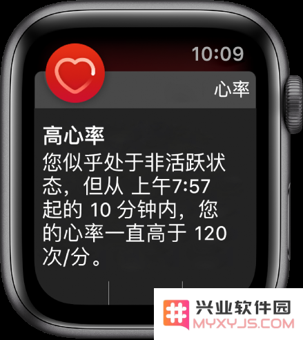 如何使用 Apple Watch 监控心律异常？