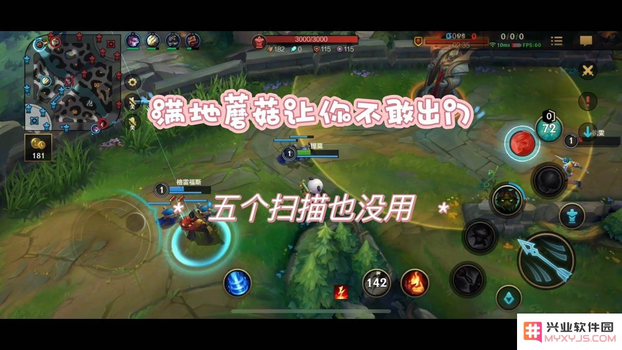 英雄联盟扫描叫什么