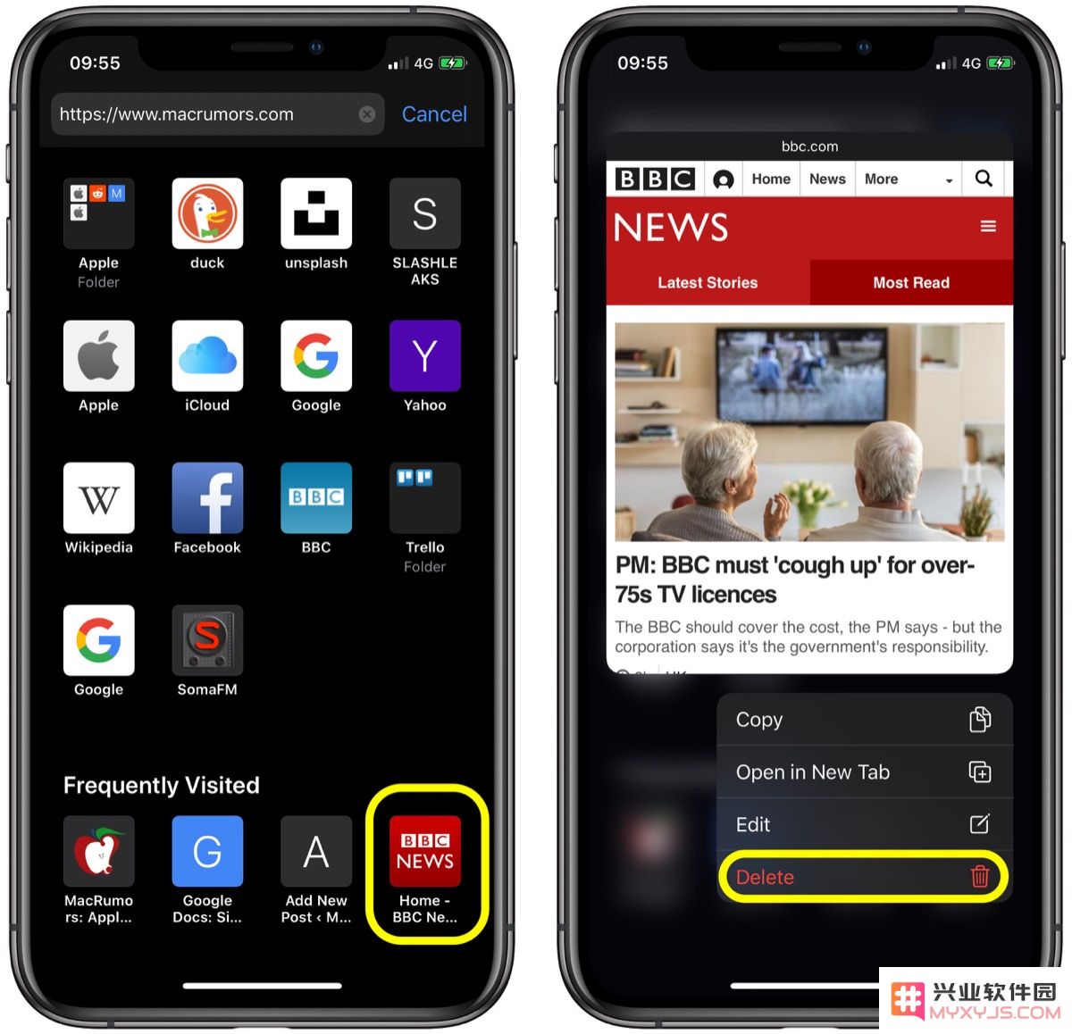 如何在 iOS 设备中的 Safari 起始页删除常访网站？