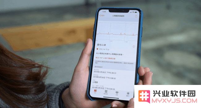 国行版本的 Apple Watch 如何激活使用 ECG 心电图功能？