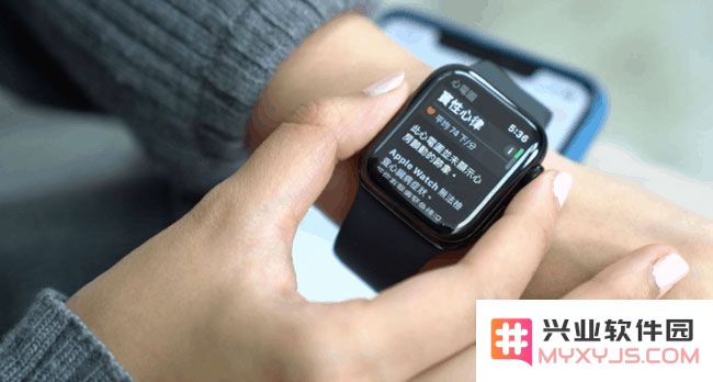 国行版本的 Apple Watch 如何激活使用 ECG 心电图功能？